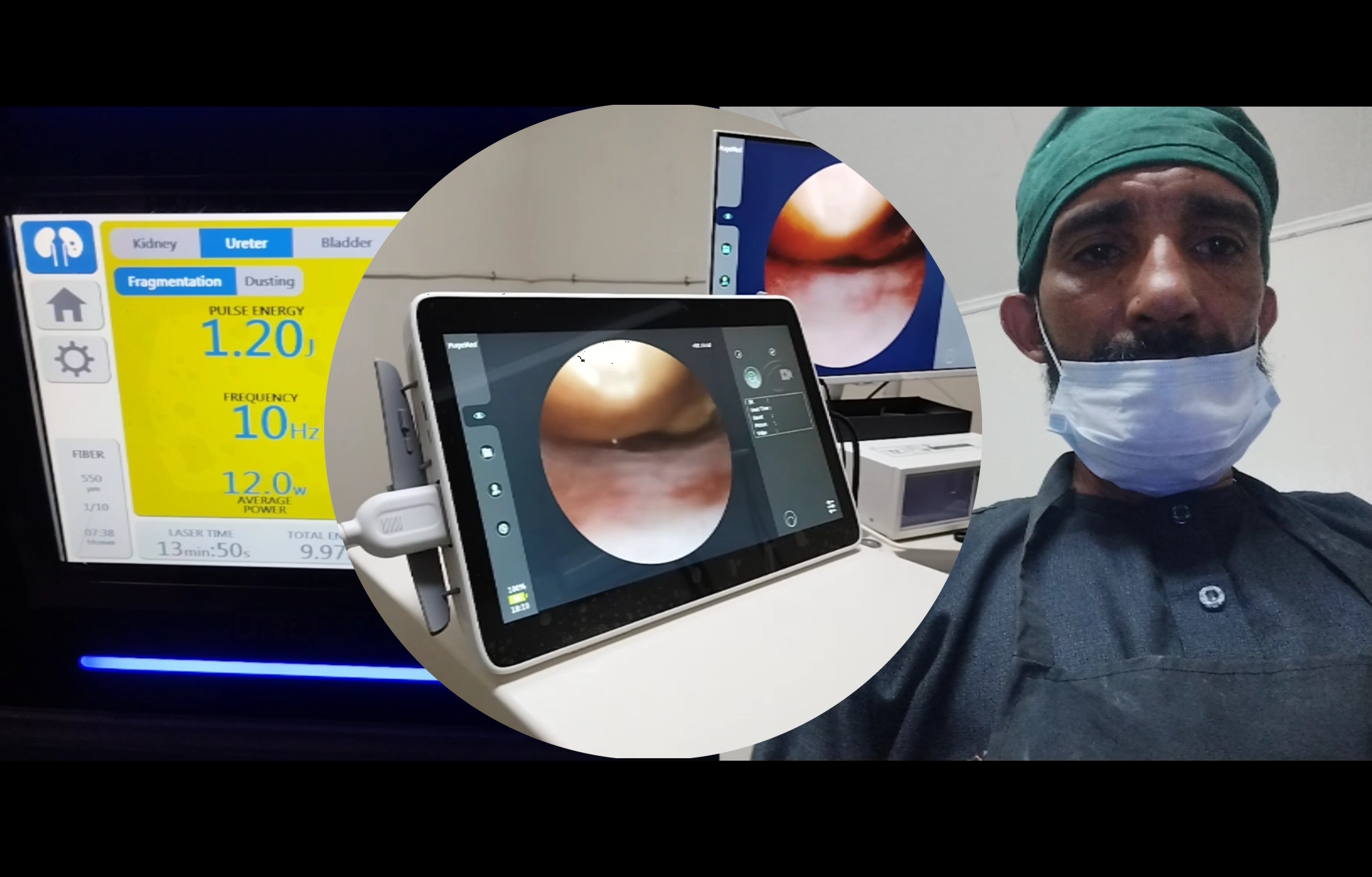 Medical laser system